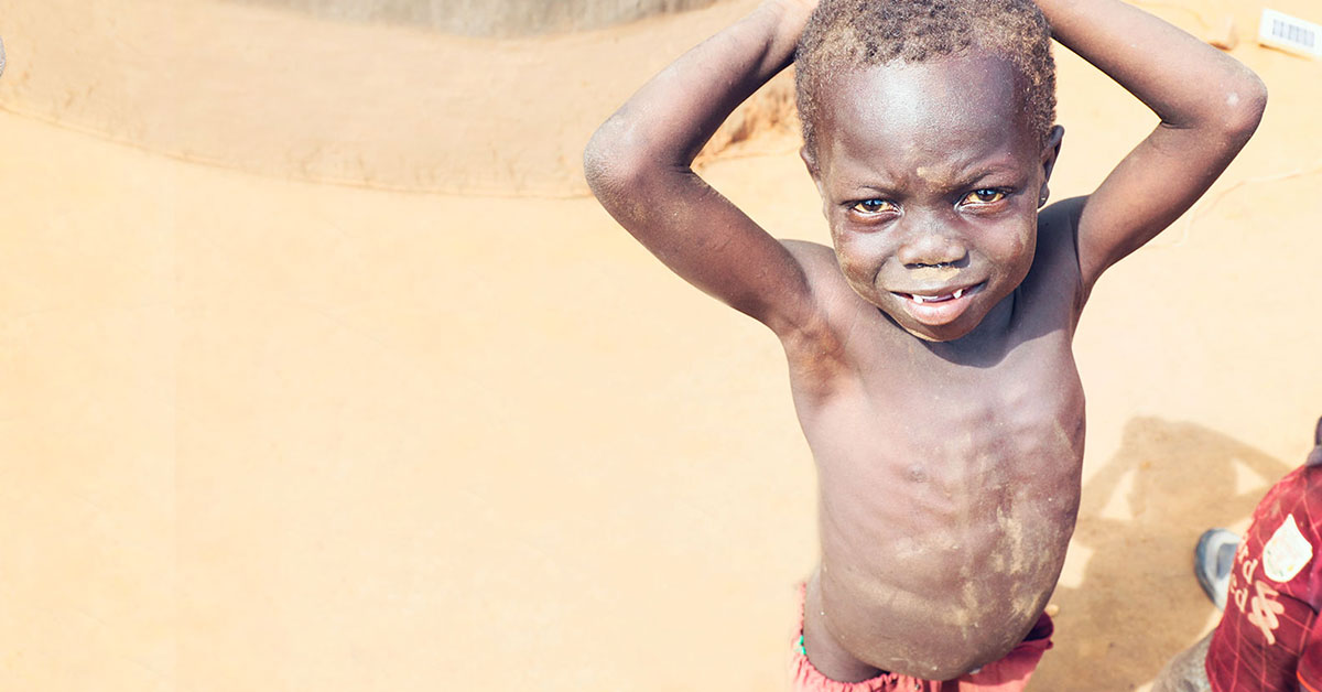 Extreme hunger crisis: How you can help