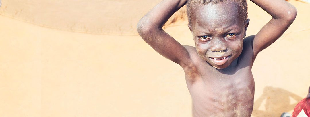 Swollen bellies. Thinning hair. You can help end this starvation.
